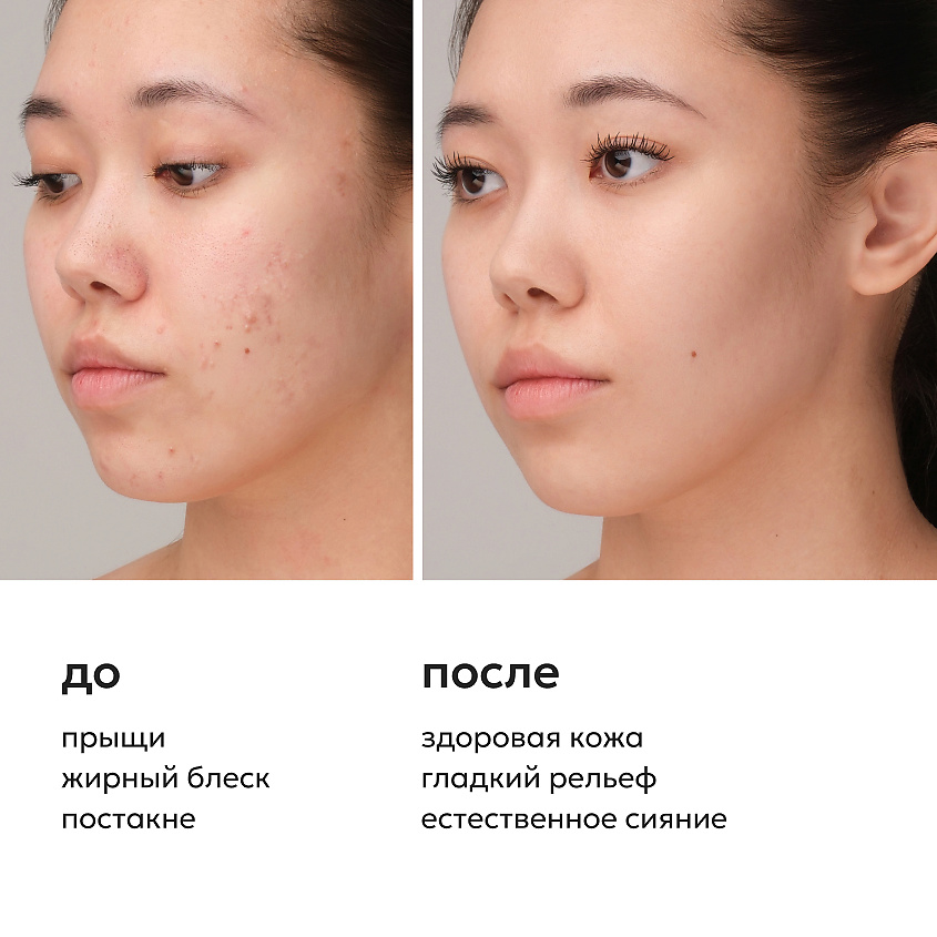 LIKATO Концентрированная сыворотка корректор с гликолиевой кислотой 5% Glycolic Acid Serum – фото 4