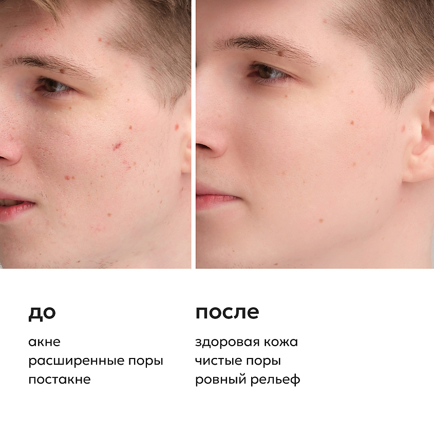LIKATO Пилинг для лица с гликолевой кислотой 10% Glycolic Acid Face Peeling – фото 4