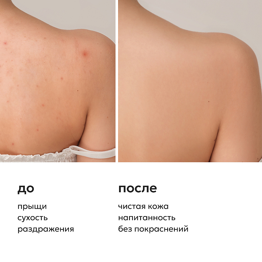 LIKATO Гель для душа успокаивающий против несовершенств кожи No Acne Skin Shower Gel – фото 4