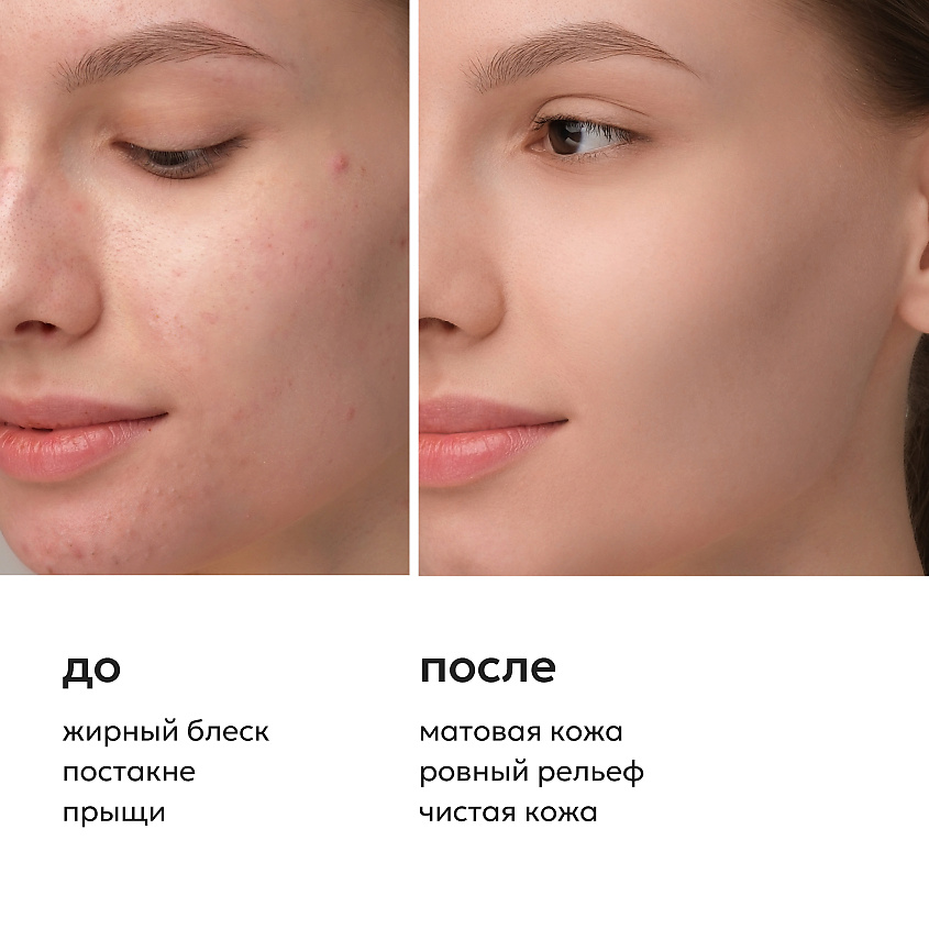 LIKATO Сыворотка для лица с фруктовыми кислотами Acids Complex Serum – фото 3