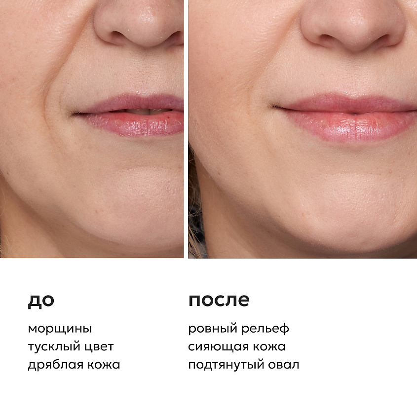 LIKATO Маска для лица с витамином С ботокс-эффект Vitamin C Face Mask – фото 3