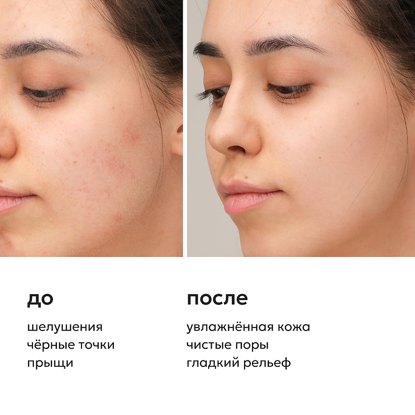 LIKATO Сыворотка для лица с миндальной кислотой Mandelic And Hyaluronic Acids Serum – фото 3