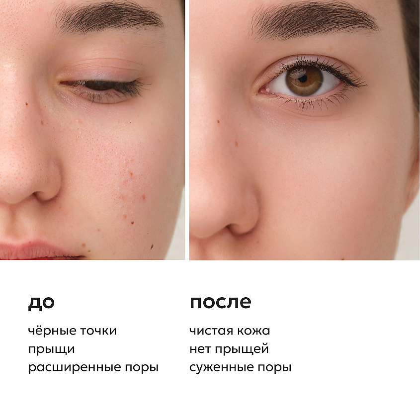LIKATO Маска от черных точек Salicylic Acid And Charcoal Face Mask – фото 4