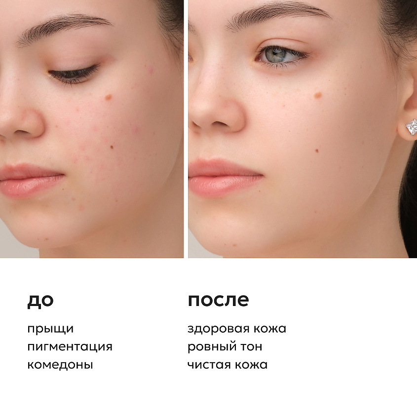 LIKATO Мультикислотный пилинг для лица с AHА+ВНА кислотами Acids Complex Face Peeling – фото 4